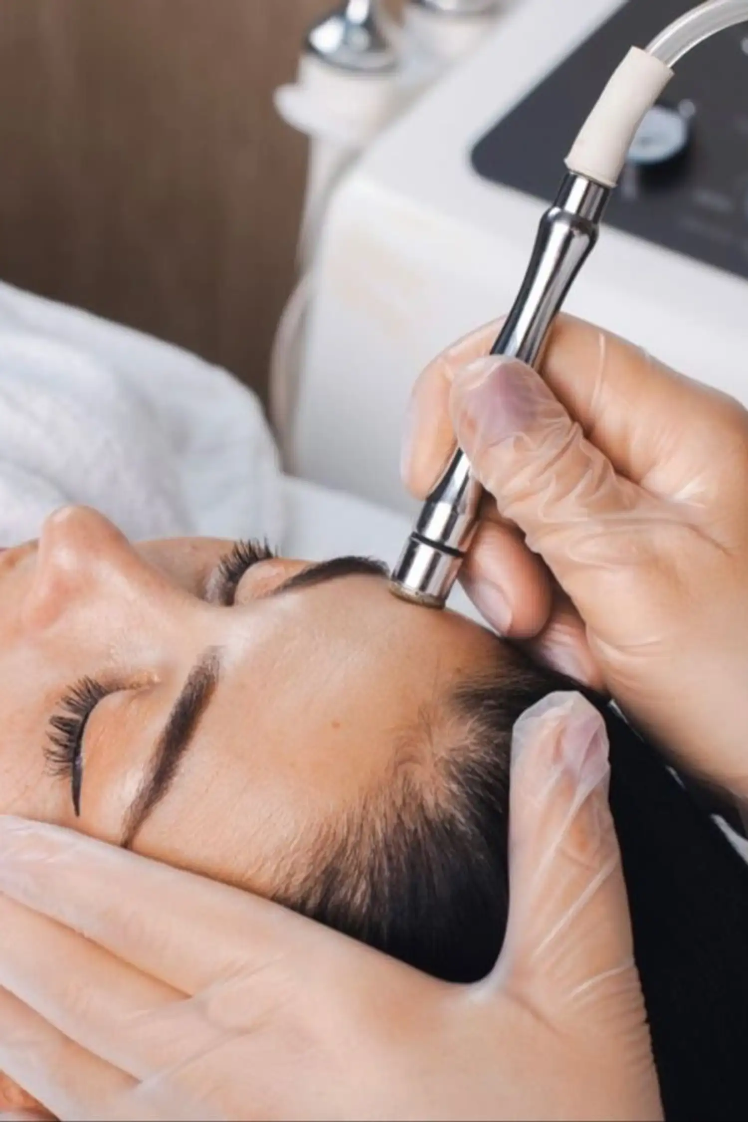 Microdermabrasion Fein & Klar