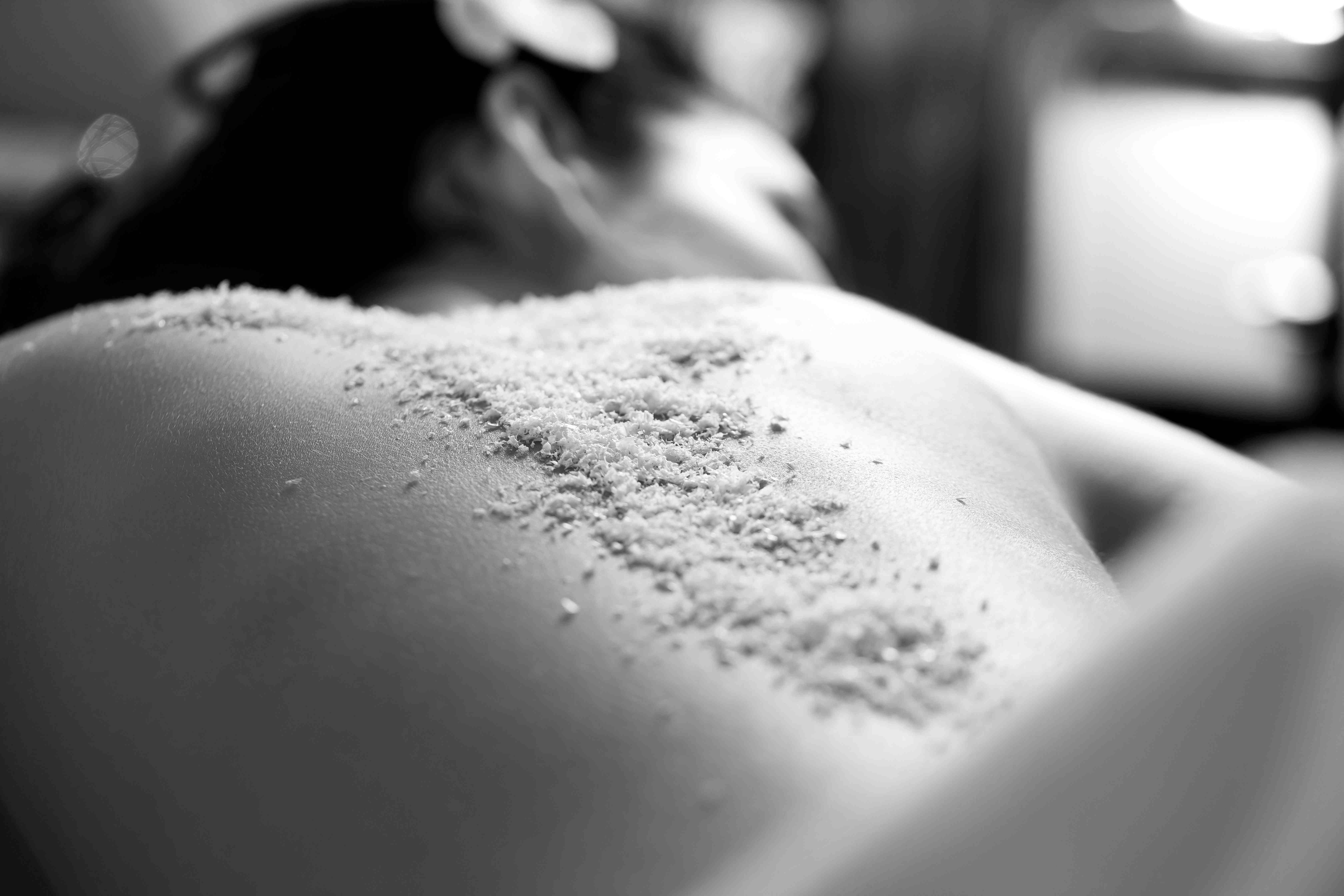 Peeling