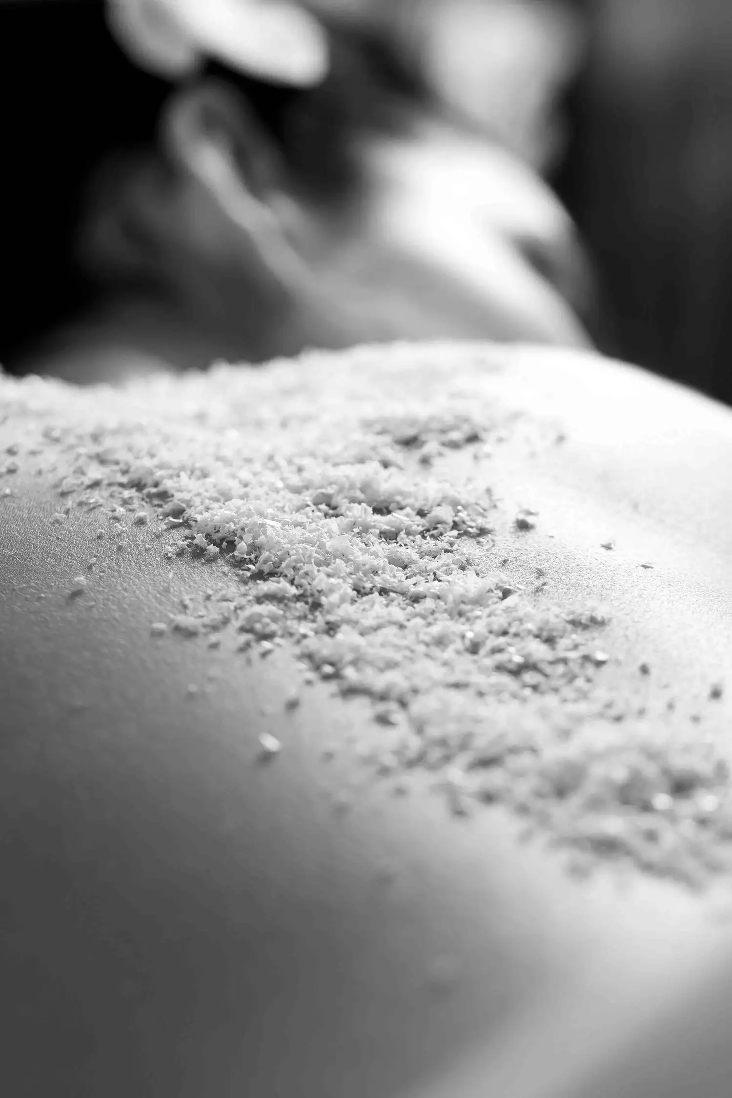 Peeling
