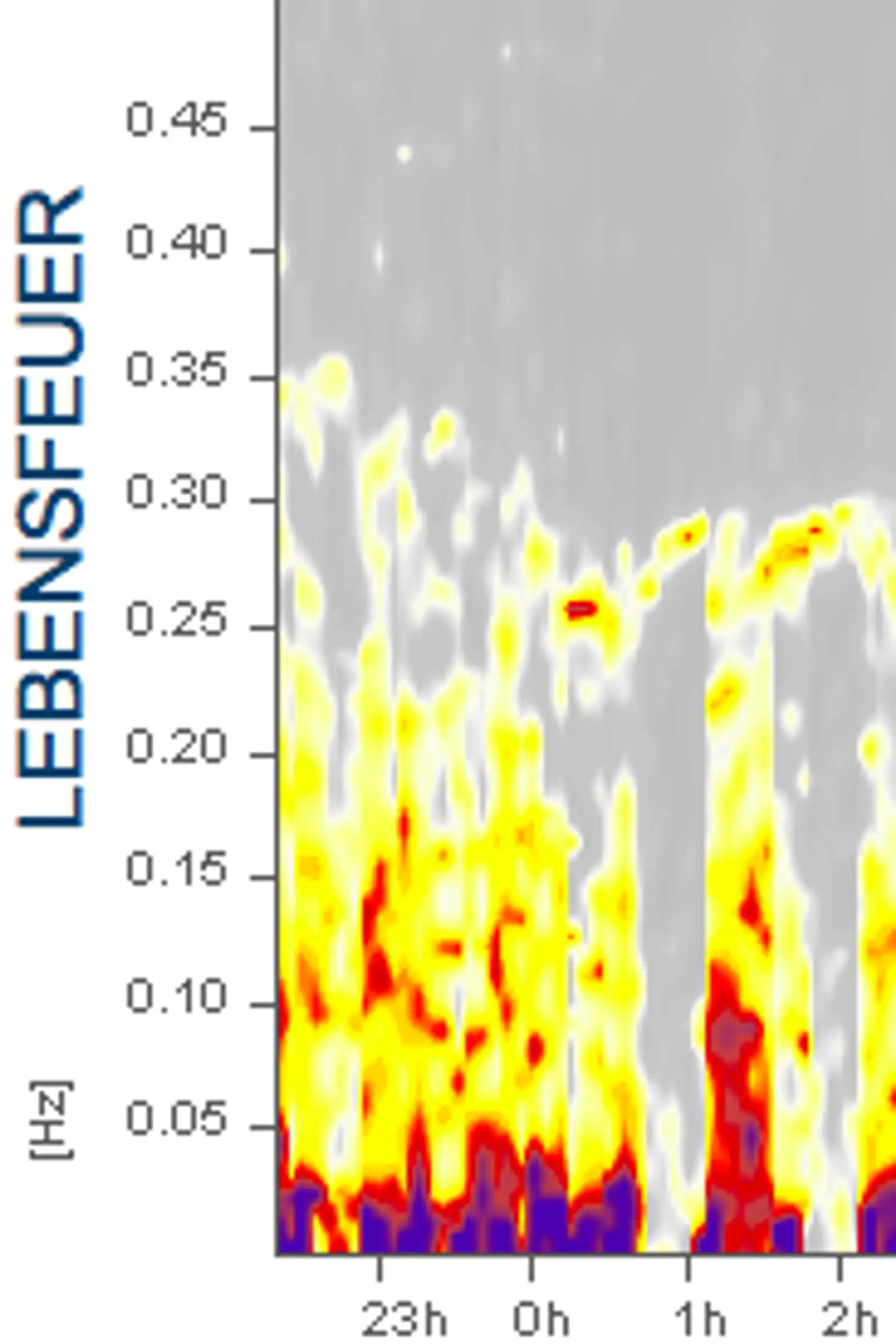 High-End HRV-Analyse