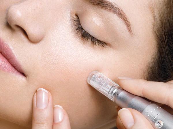 Ameson Micro-Needling